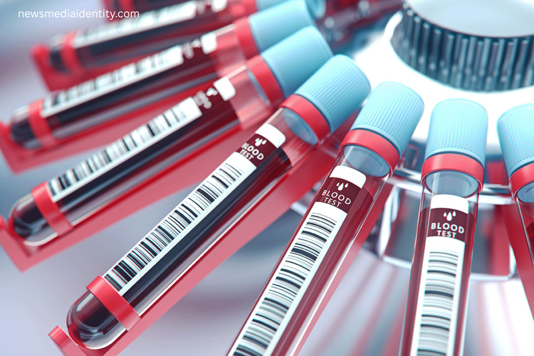 Future of Blood Test Innovation in Aging Science